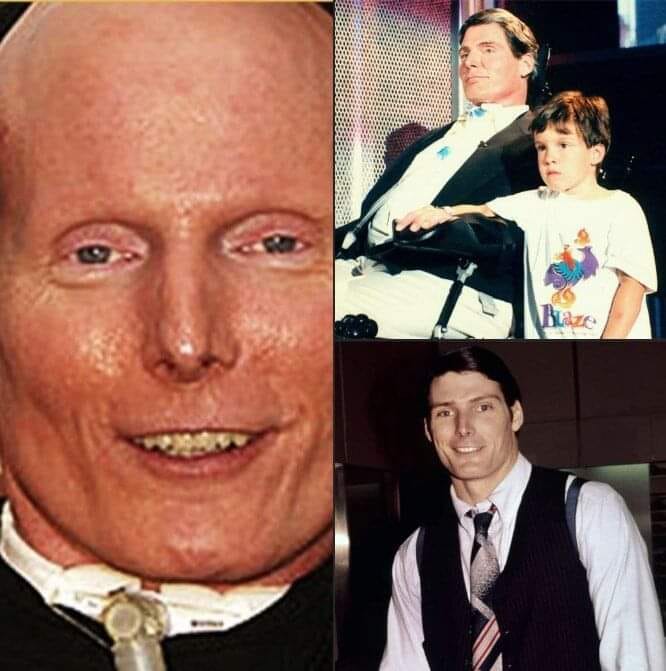 Christopher Reeve's Wife Died From Lung Cancer 17 Months After Him, Leaving Their Young Son Orphaned