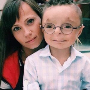 Woman adopts a boy no one wanted to adopt: see what he looks like now